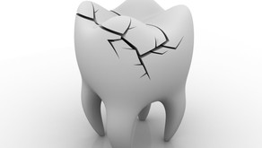 Causes of Toothaches
