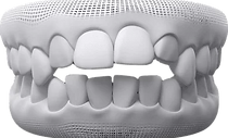 teeth4.png