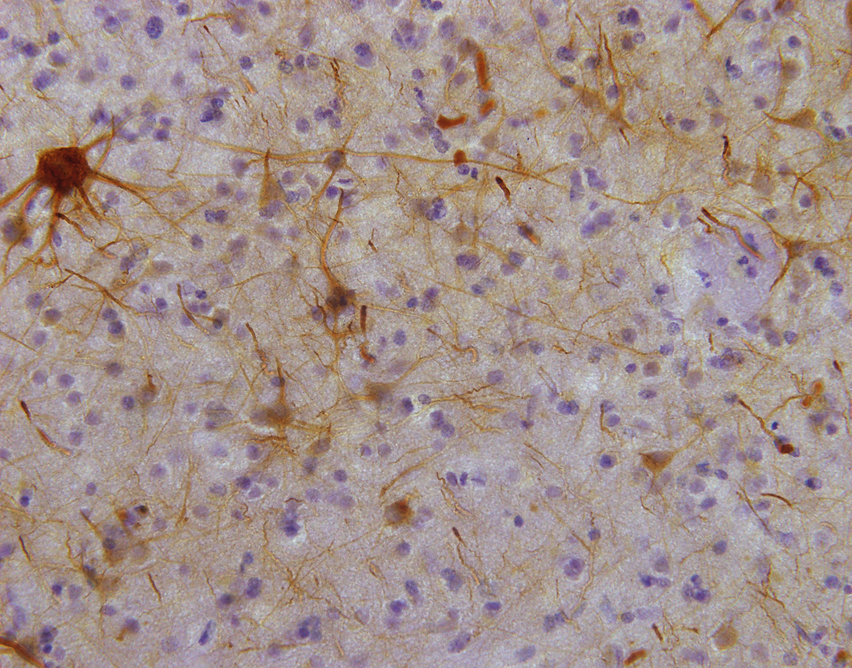B19 Visual Cortex Human TS x40.tif