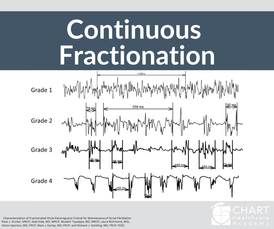 Six Terms that Decode the Funky Signals of Arrhythmias