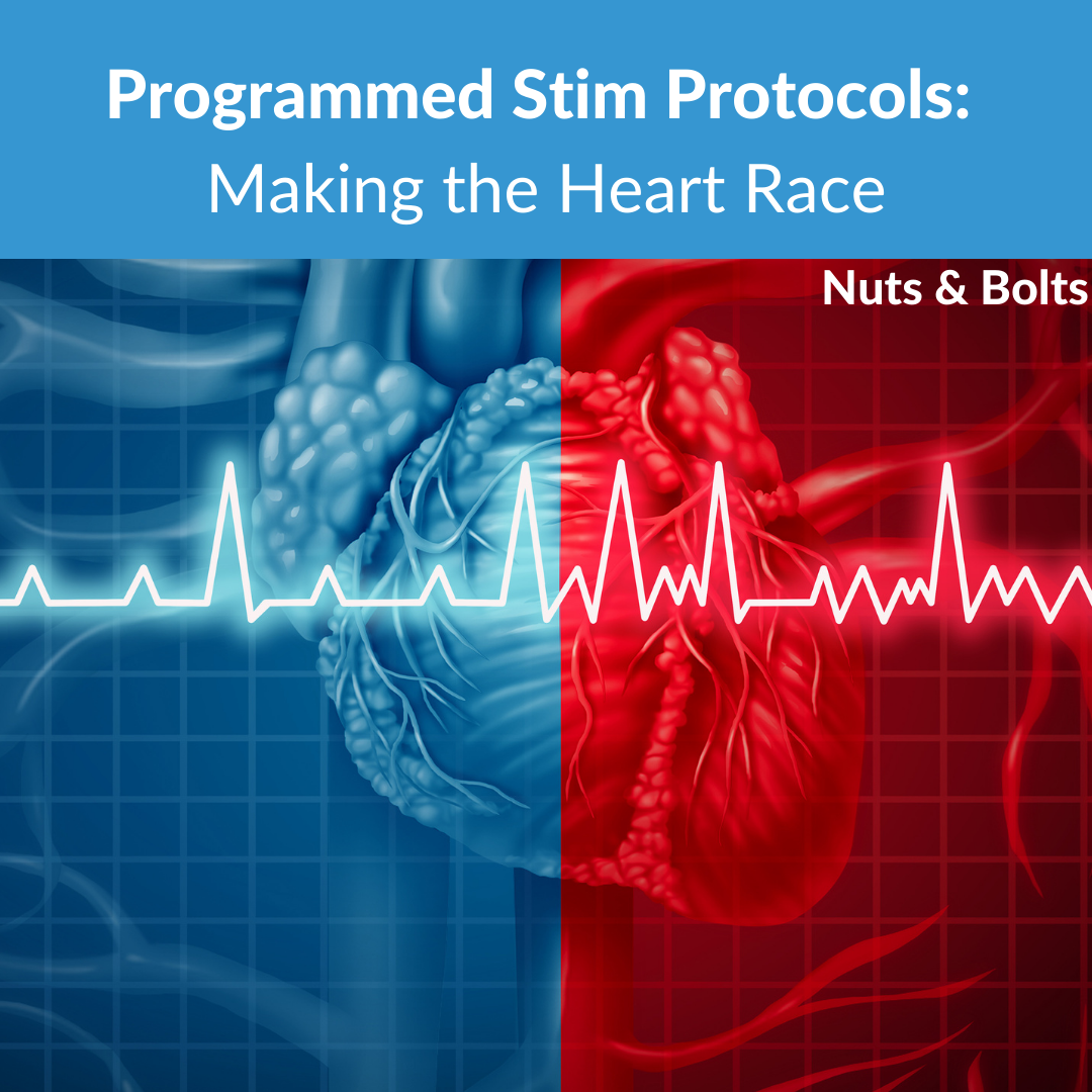 *Programmed Stim Protocols: Making the Heart Race