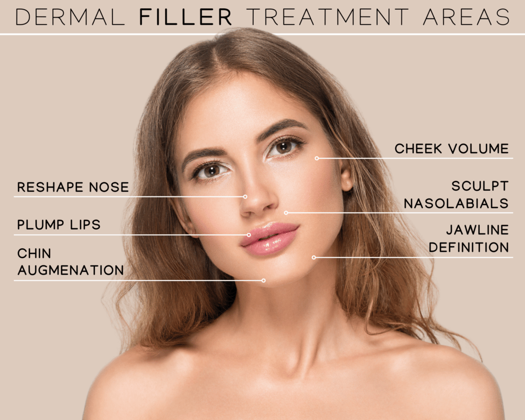 Doctor-led dermal filler injection treatment at My Harley Medical Harley Street