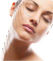 Non-surgical thread face and neck lift with Relife Menarini threads at My Harley Medical
