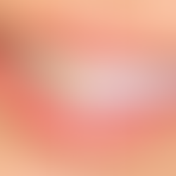 Clareamento dental: quando vale a pena e como manter os resultados