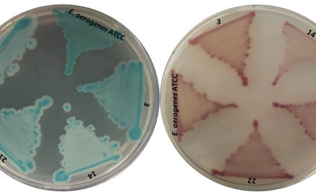 High fluoride resistant bacteria from water samples of Dindigul district, Tamil Nadu, South India