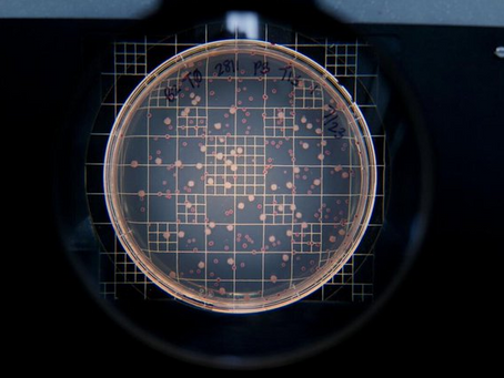 Trained viruses prove more effective at fighting antibiotic resistance