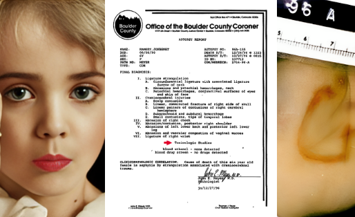 "Unveiling Shadows: Decades of Intrigue Surrounding the Unsolved Mystery of JonBenét Ramsey"