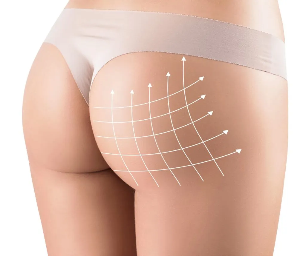 Vacuum-buttock-therapy-3.jpeg.webp