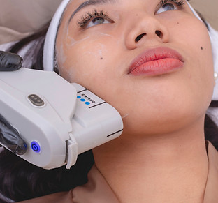 A young woman undergoing HIFU treatment for her jawline. High Intensity Focused Ultrasound