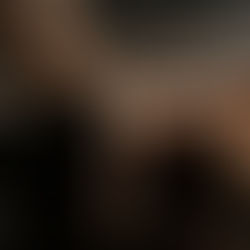 What’s Better: LPG Massage, Cavitation, or RF Lifting?