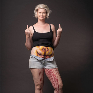 mit Bodypainting Auf den Bauch gemalte Endometriose Schmerzen sichtbar machen