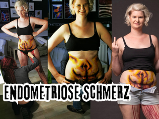 Sichtbar gemalte Schmerzen von Endometriose auf dem Bauch mit Bodypainting gemalt