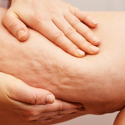 get rid of saggy skin
