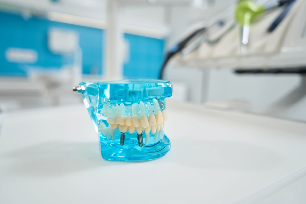 all on 4 dental implants