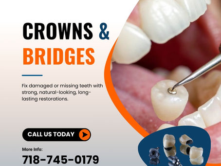 Missing Teeth? Here’s How Crown and Bridge Can Transform Your Smile Instantly