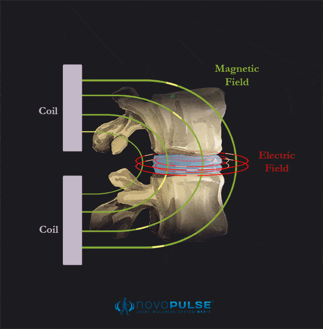 Joint-Wellness-Novo-Pulse-Belleview-FL-Simulation.gif