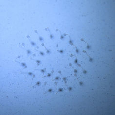 Green Lacewing Eggs