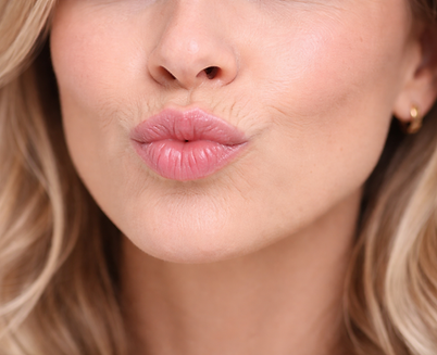 Botox gegen Raucherfältchen im Lippenbereich in Dinkelsbühl im Raum Ansbach