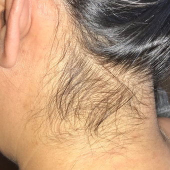 Before neck.webp