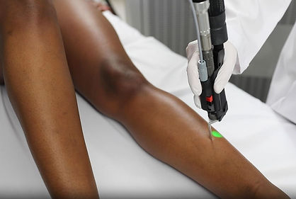 Amps Lower Leg.JPG