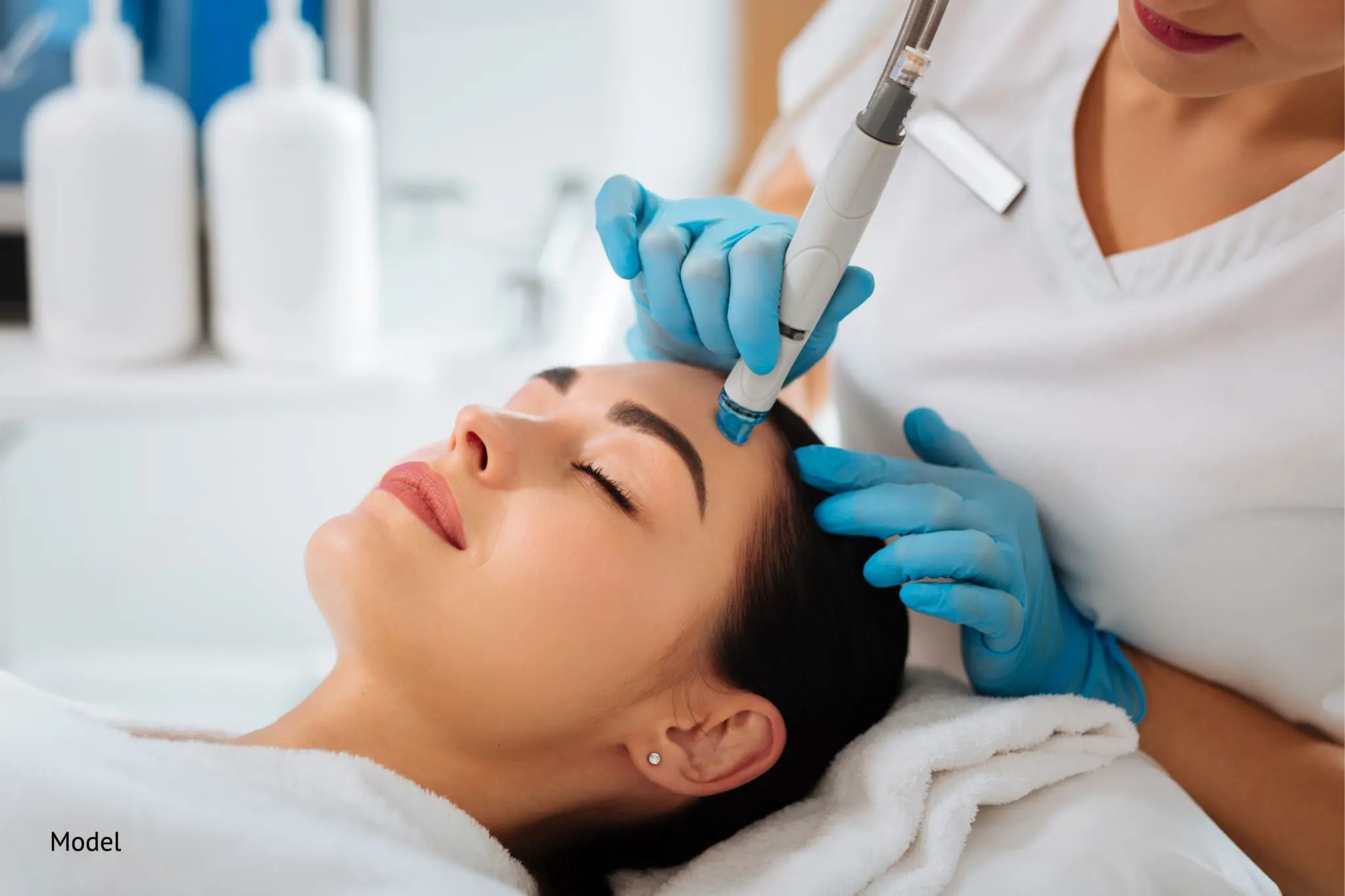 microneedling-with-dermapen-compressor-2048x1365.webp