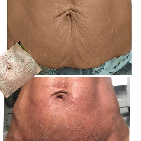 peeling_algues003.webp