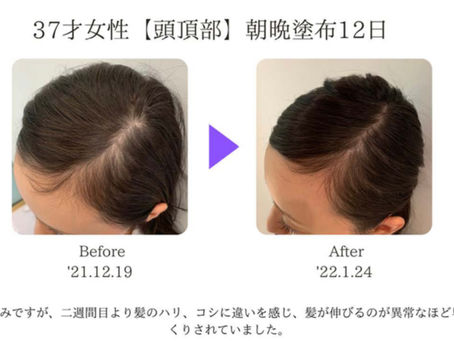 自宅で出来る‼️髪の若返りを実感✨