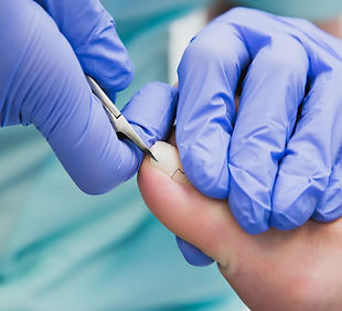 unha encravada_edited.jpg