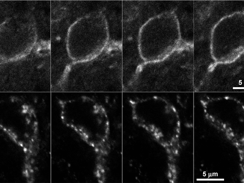 Microscope images of neurons with and without internalization of the neuropeptide Y receptor.