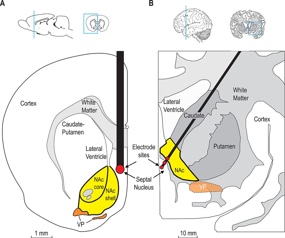 Position of 'pleasure' electrodes in the rat brain (left) and the human brain (right).