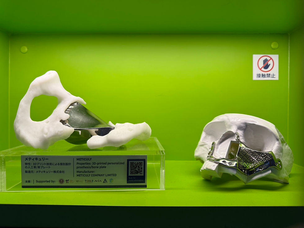Meticuly กระโหลกไทเทเนียม 3D Printing