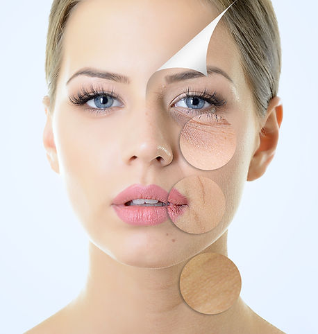 Skin Conditions
