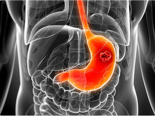 Uso prolongado de antiácidos se relaciona con un riesgo dos veces mayor de cáncer de estómago