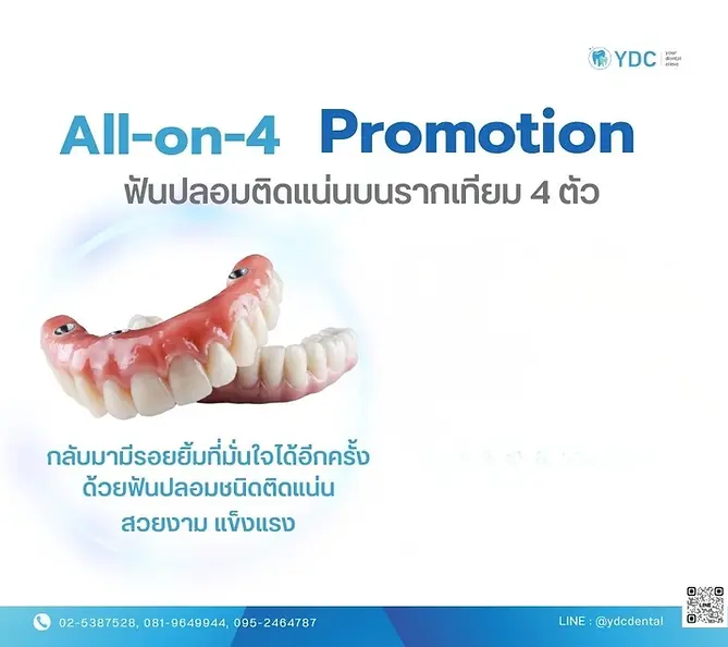 Promotion Implant 2026 .webp