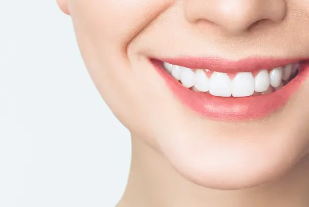 Veneer YDC Dental Clinic