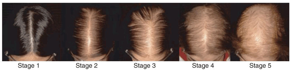 Picture1.gif