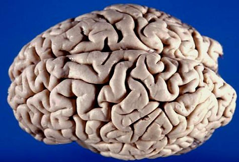 Human brain superior lateral view; .JPG