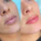 Lip Blush Tattoo