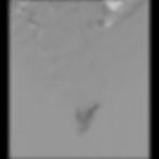 Voie radiale