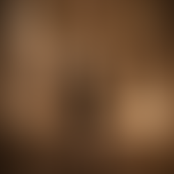 WHAT IS POETIC RESILIENCE ?