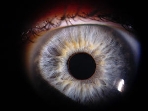 Die Sprache der Augen