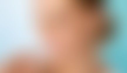 Invisalign: l’alternativa invisibile all’apparecchio ortodontico