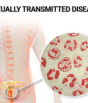 Sexually-transmitted-disease.jpg