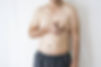 gynecomastie - lipossuccion poitrine homme - dr danino.jpeg
