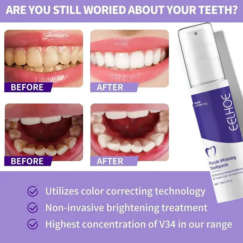 Thumbnail: 2026 Bestselling Whitening Toothpaste Say Goodbye To Yellow Teeth Oral Hygiene C