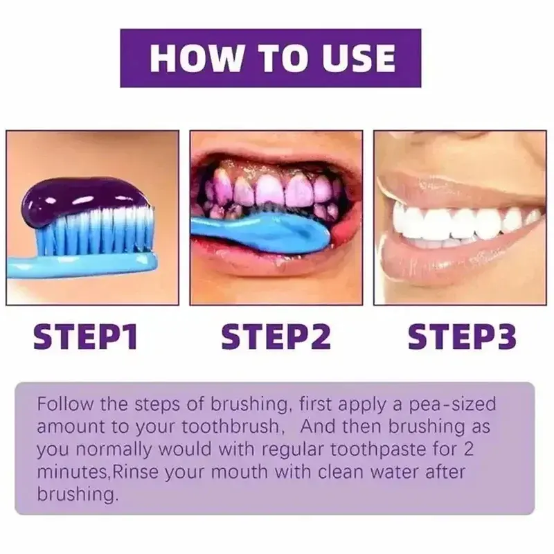 Thumbnail: 2026 Bestselling Whitening Toothpaste Say Goodbye To Yellow Teeth Oral Hygiene C
