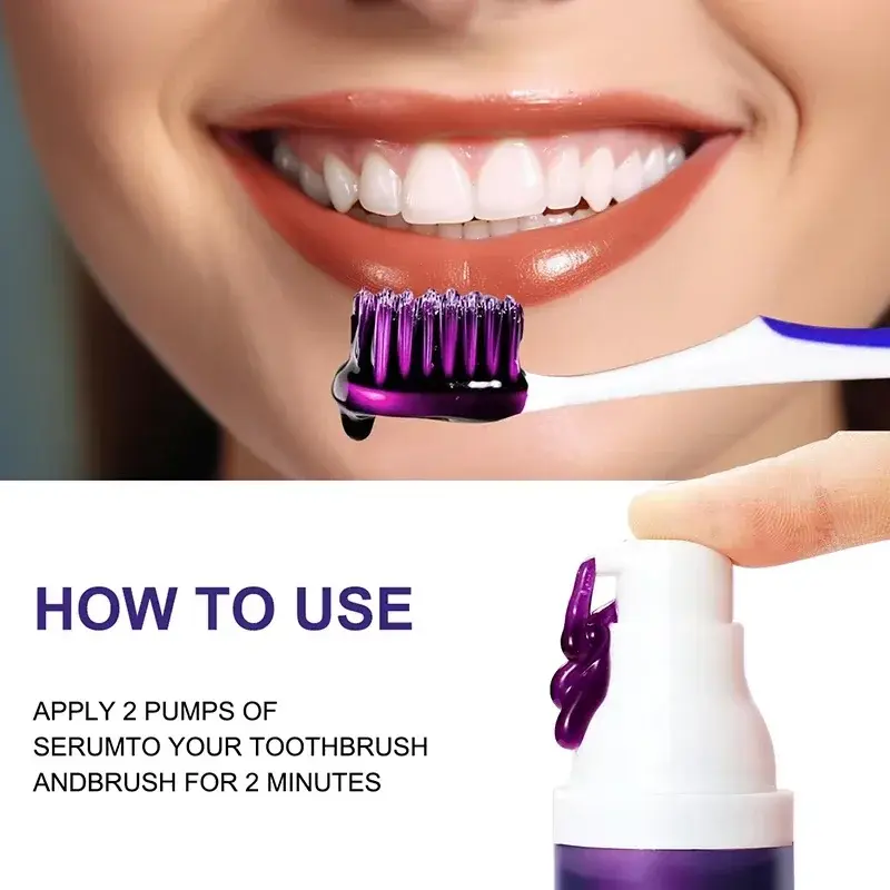 Thumbnail: 2026 Bestselling Whitening Toothpaste Say Goodbye To Yellow Teeth Oral Hygiene C