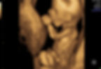 Detailed 3D/4D ultrasound scan showing a fetus in the womb.