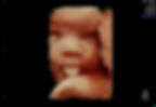 Detailed 3D/4D ultrasound scan showing a baby face.