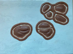 Heavy Swollen Eyes and Lumps Sculpt